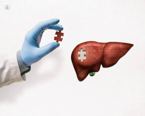 trasplante-hepatico-oportunidad-de-vida imagen de artículo