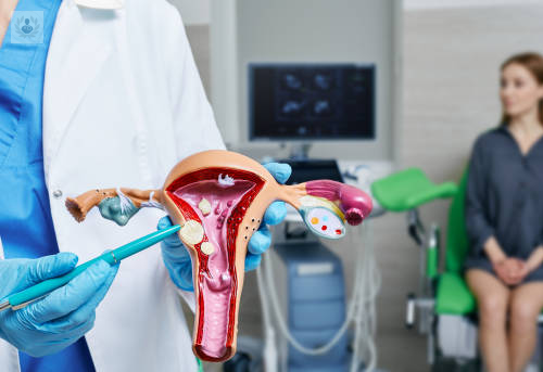 los-miomas-uterinos-tumores-benignos-del-utero imagen de artículo
