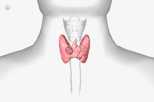 nodulos-tiroideos-exploracion-diagnostico-y-tratamiento imagen de artículo