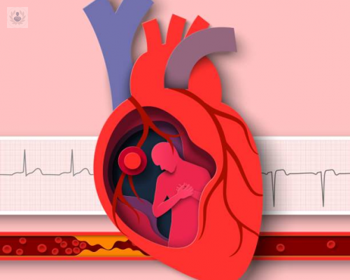 Dislipidemia: Un desorden metabólico de alto riesgo cardiovascular