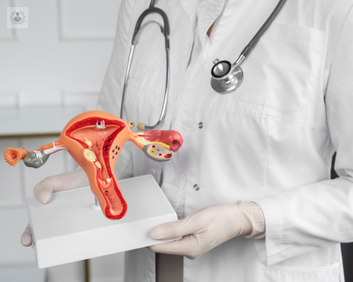 todo-sobre-los-miomas-uterinos-sintomas-causas-y-tratamiento imagen de artículo