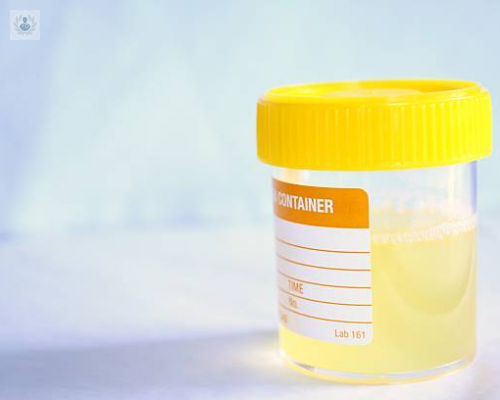 Proteinuria: Un marcador clave de salud renal