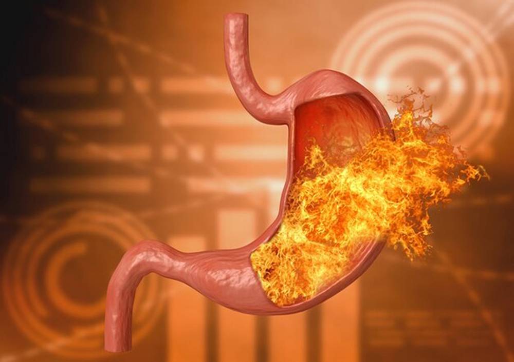 ¿Qué causa la Gastritis? Descubre las posibles causas y factores de riesgo.