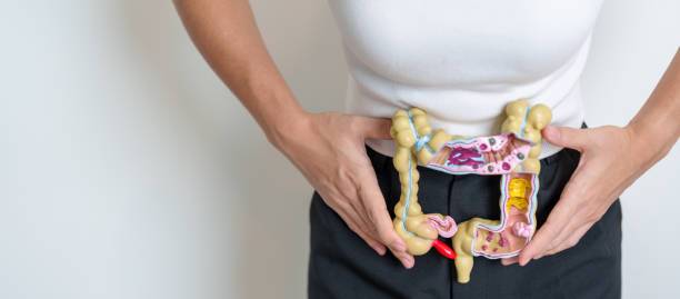 diverticulosis-una-condicion-intestinal-con-potenciales-complicaciones imagen de artículo
