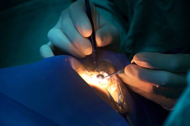 Avances en la Cirugía de Cataratas: Una visión clara hacia el futuro