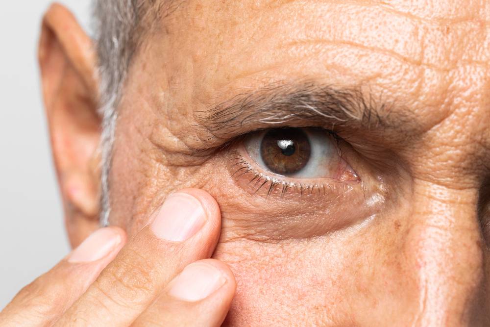 Glaucoma: Detección temprana para conservar la vista