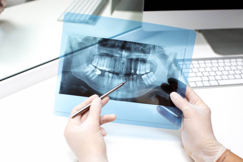 ortopedia-maxilar-procedimientos-para-disminuir-deficiencias-craneofaciales imagen de artículo