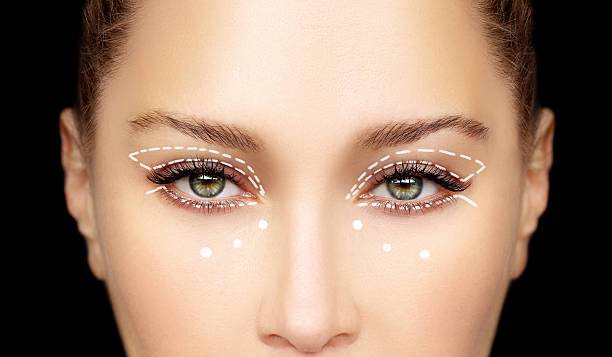 blefaroplastia-cirugia-para-rejuvenecer-la-mirada imagen de artículo