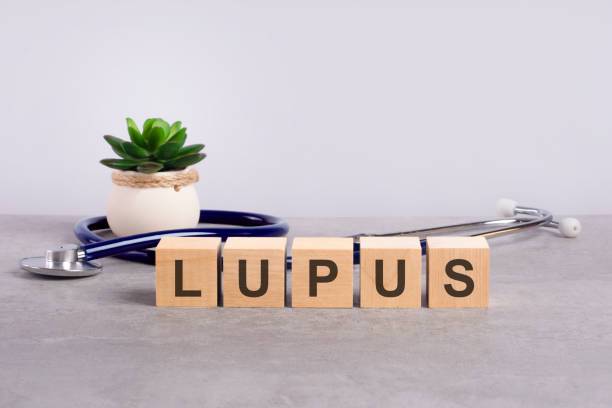 Lupus: Un gran imitador con muchas caras