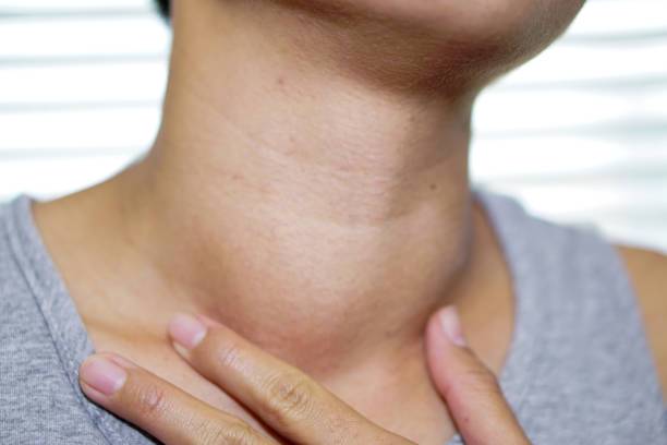 cancer-de-tiroides-un-enemigo-silencioso imagen de artículo