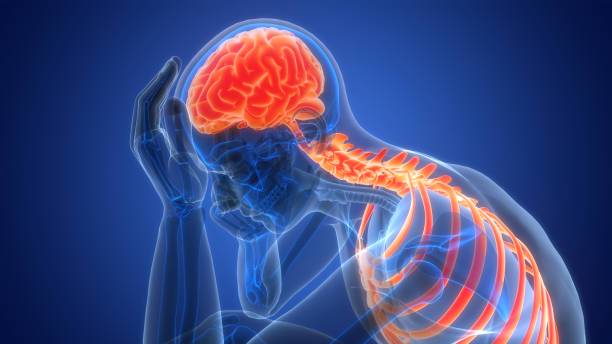 infarto-cerebral-una-emergencia-que-requiere-atencion-inmediata imagen de artículo