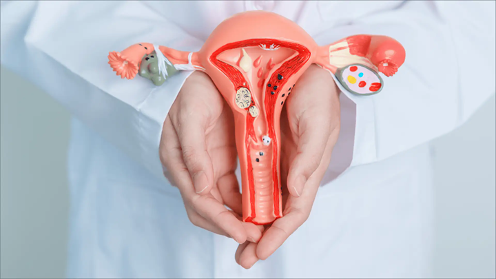 dolor-pelvico-miomas-o-algo-mas imagen de artículo