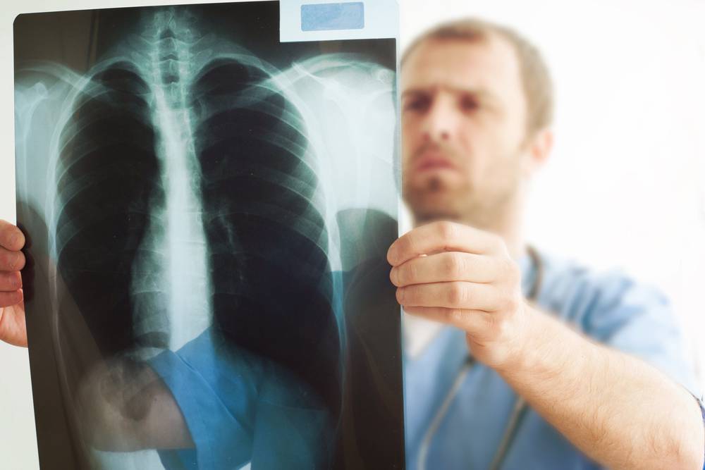 tromboembolia-pulmonar-reconociendo-los-signos-de-emergencia imagen de artículo