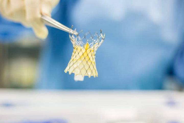 avances-en-cardiologia-que-es-el-tavi imagen de artículo