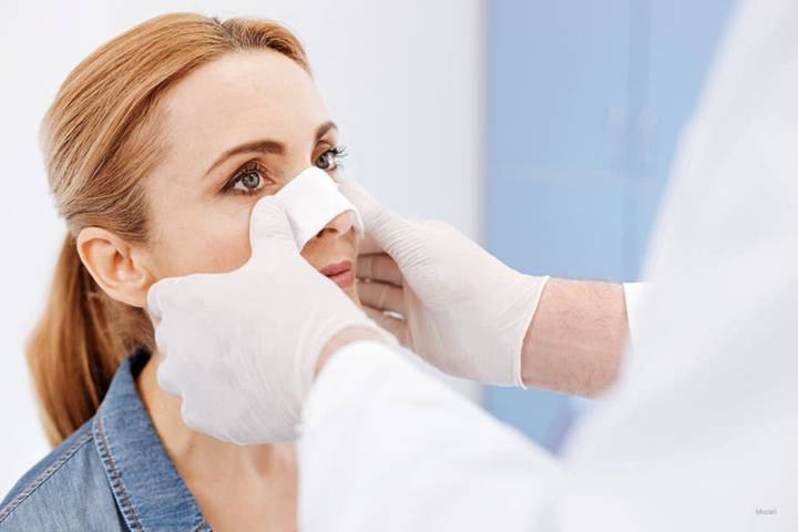 cuidados-postoperatorios-de-la-rinoplastia-lo-que-debes-saber imagen de artículo