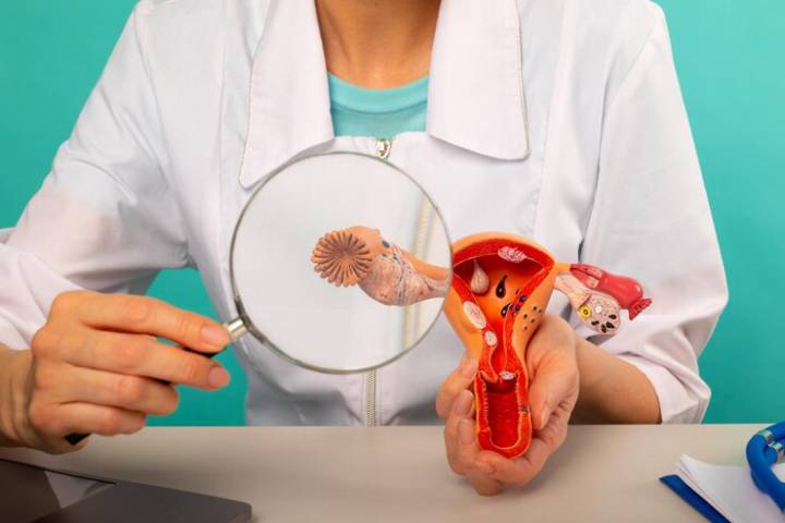 impacto-sindrome-ovario-poliquistico-en-salud-reproductiva-mujer imagen de artículo