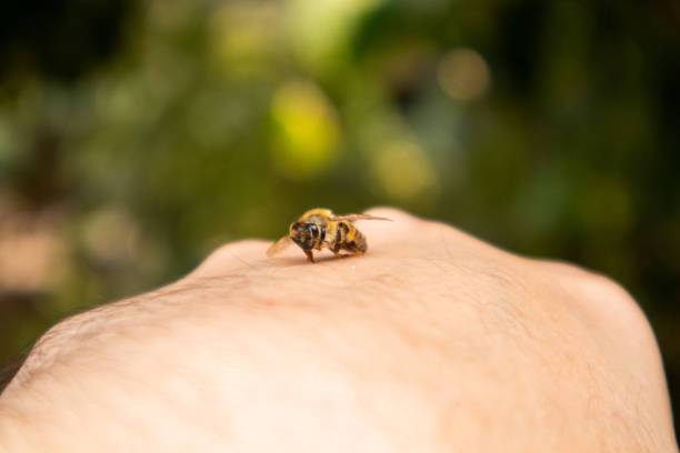 picadura-de-abeja-conoce-los-sintomas-y-como-afecta-el-veneno-a-tu-cuerpo imagen de artículo