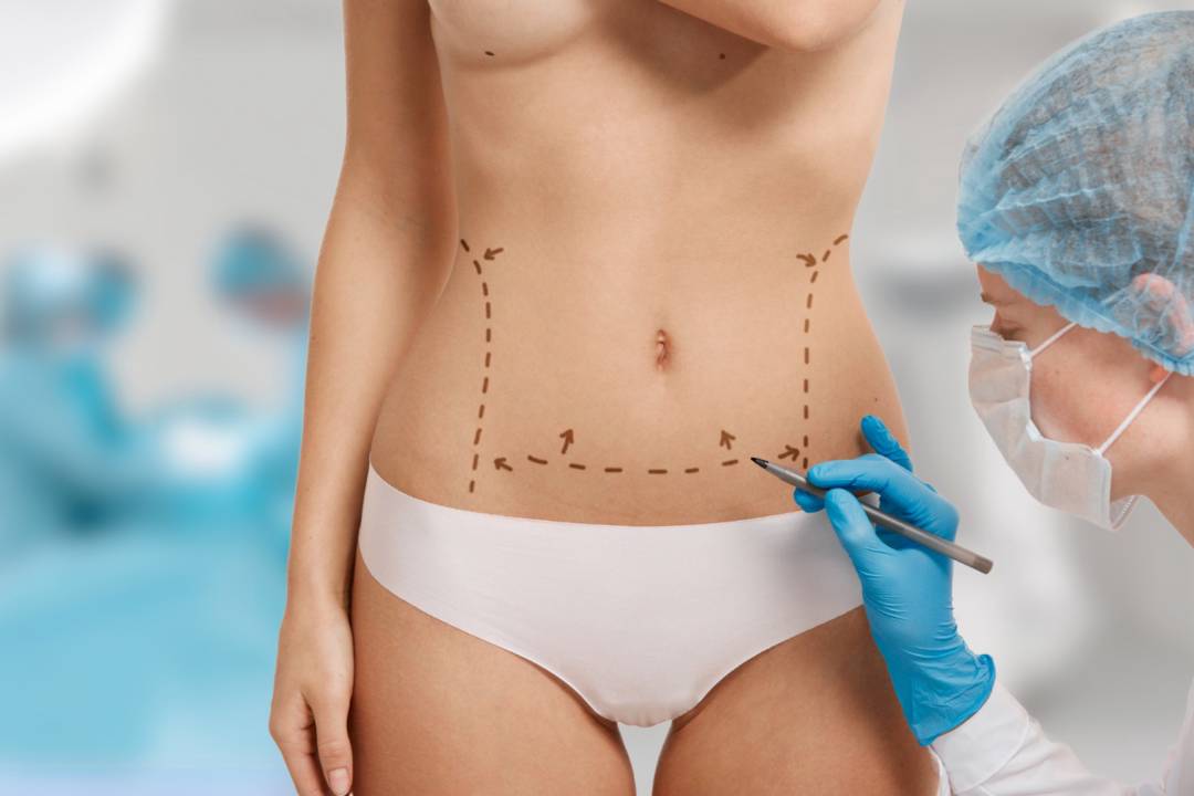 curvas-esteticas-como-cirugia-plastica-transforma-belleza-femenina imagen de artículo