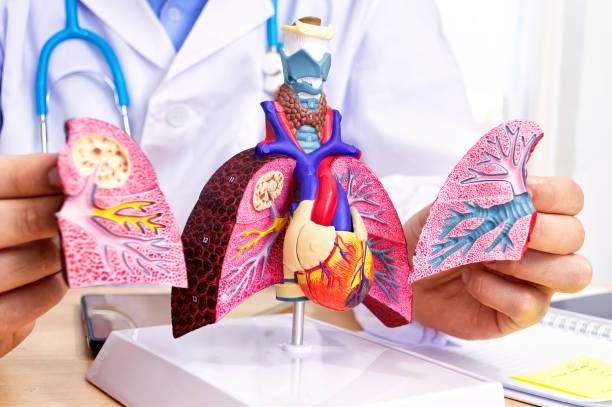 tromboembolia-pulmonar-conoce-las-medidas-preventivas imagen de artículo