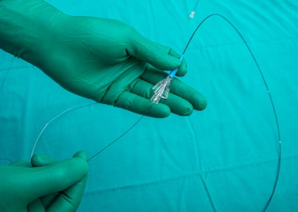 procedimientos-cardiovasculares-minimamente-invasivos-innovaciones-y-beneficios imagen de artículo