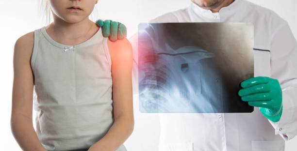 traumatologia-infantil-todo-lo-que-necesitas-saber imagen de artículo