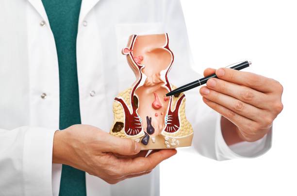 diagnostico-y-tratamiento-de-las-hemorroides-un-enfoque-practico imagen de artículo