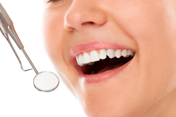 carillas-dentales-porcelana-mitos-verdades-debes-conocer imagen de artículo
