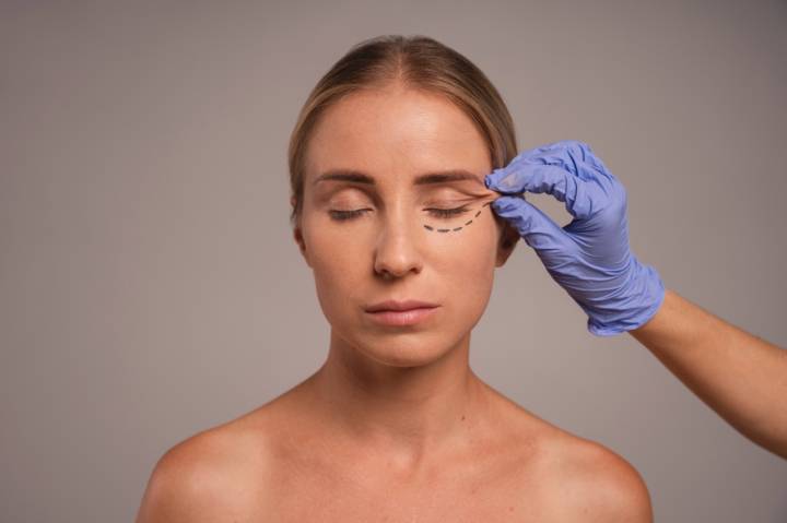 blefaroplastia-mejora-apariencia-parpados-rejuvenece-mirada imagen de artículo