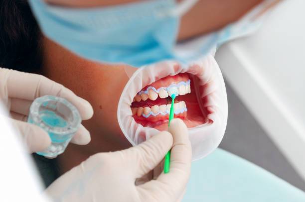 la-odontologia-estetica-un-pilar-en-la-armonia-facial imagen de artículo
