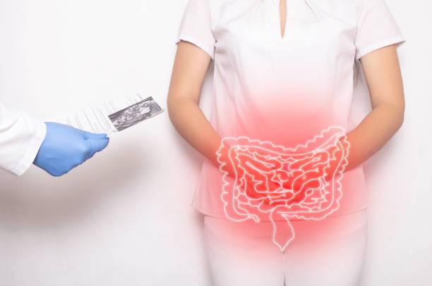 enfermedad-diverticular-la-prevencion-esta-en-tus-manos imagen de artículo