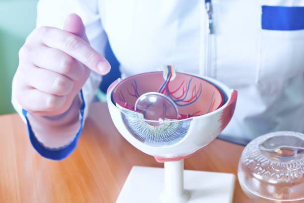 facoemulsificacion-la-solucion-efectiva-para-cataratas imagen de artículo