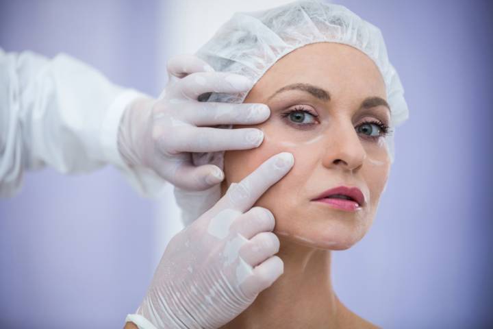 blefaroplastia-y-toxina-botulinica-soluciones-esteticas-para-una-mirada-mas-joven imagen de artículo