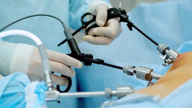 cirugia-laparoscopica-la-revolucion-de-la-cirugia-minimamente-invasiva imagen de artículo