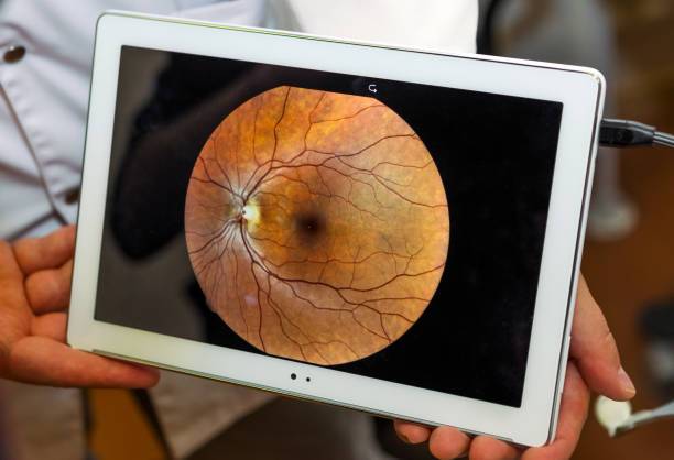 salud-ocular-las-enfermedades-visuales-mas-comunes-y-como-prevenirlas imagen de artículo