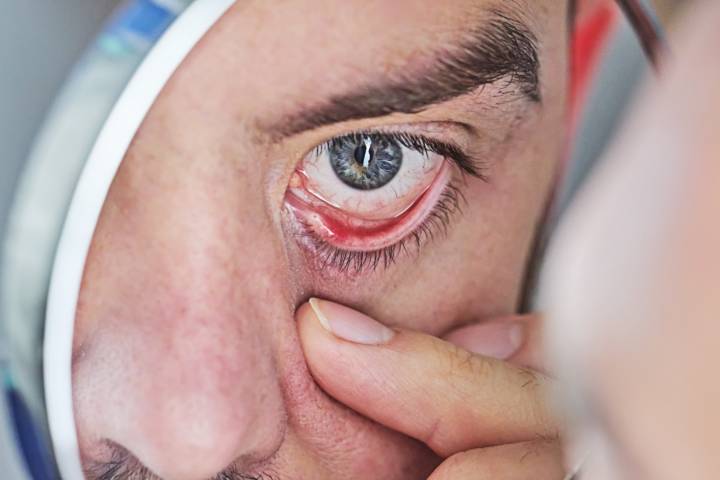 glaucoma-enfermedad-ocular-silenciosa-puede-causar-ceguera imagen de artículo