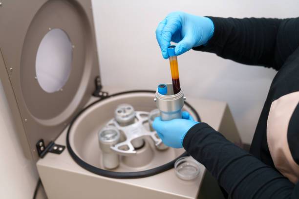 plasma-rico-en-plaquetas-un-tratamiento-regenerativo imagen de artículo