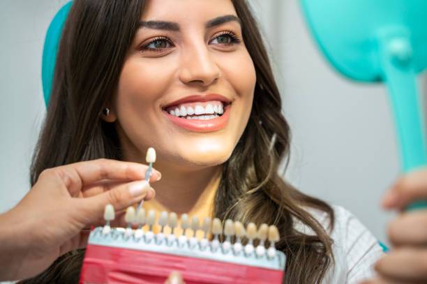 blanqueamiento-dental-tips-y-recomendaciones imagen de artículo
