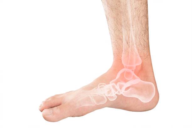 entendiendo-la-inestabilidad-cronica-de-tobillo imagen de artículo
