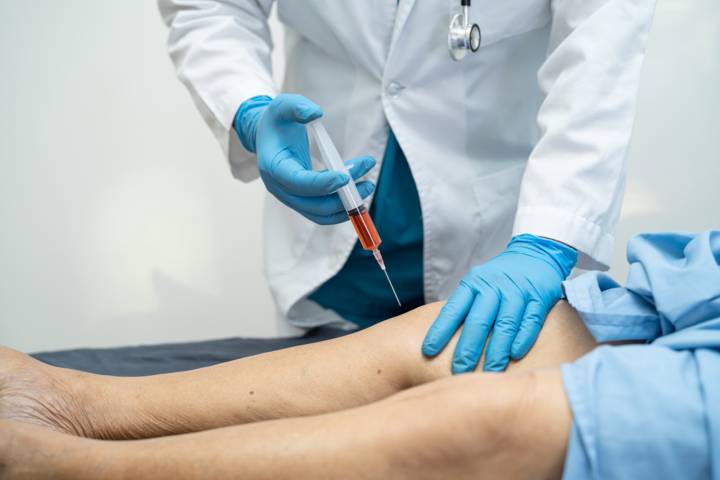 escleroterapia-procedimiento-cuidados-y-beneficios-para-la-salud-vascular imagen de artículo