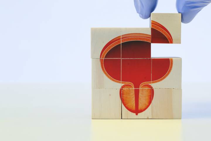 hiperplasia-prostatica-benigna-que-es-como-trata-cuando-consultar-urologo imagen de artículo