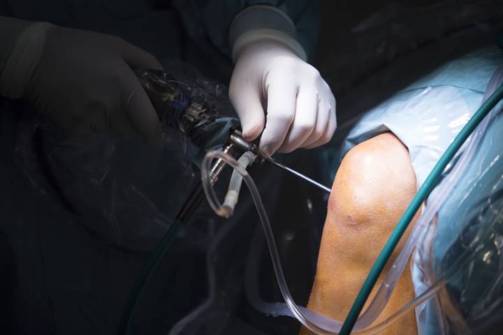 cirugiia-rodilla-robotica-precision-innovacion-beneficios-paciente imagen de artículo