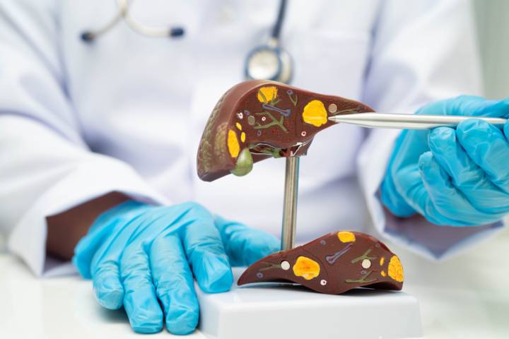 que-son-enfermedades-hepaticas-como-se-diagnostican imagen de artículo