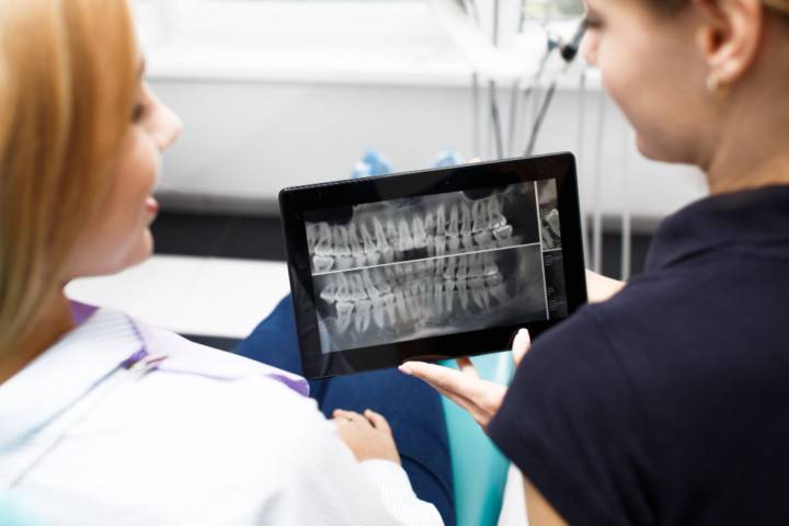 odontologia-minimamente-invasiva-arte-conservar-salud-dental imagen de artículo