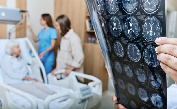 el-guardian-del-cerebro-descubre-la-labor-del-neurointensivista imagen de artículo