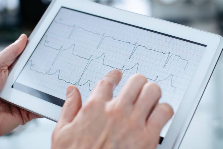electrocardiograma-que-es-para-que-sirve-como-se-realiza imagen de artículo