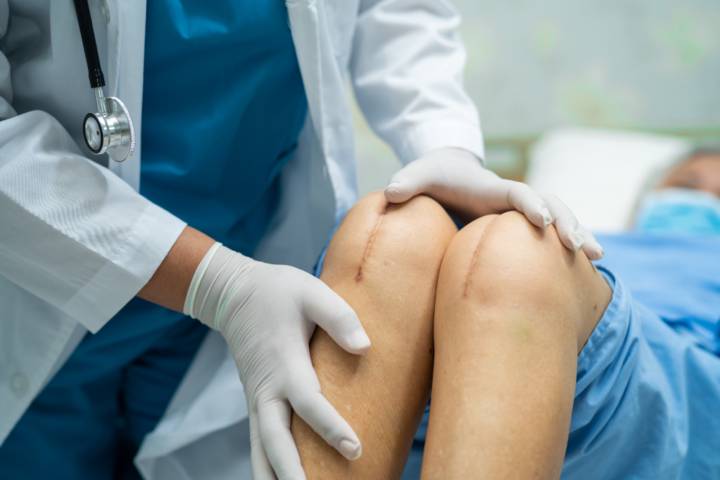 artroplastia-rodilla-que-es-cuando-esta-indicada imagen de artículo