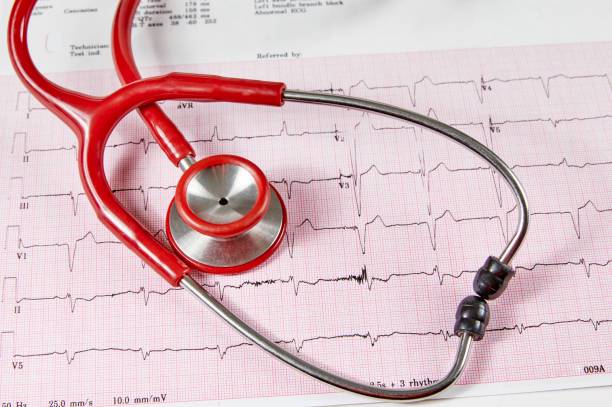 electrofisiologia-cardiaca-diagnostico-y-tratamiento-avanzado-de-las-arritmias imagen de artículo