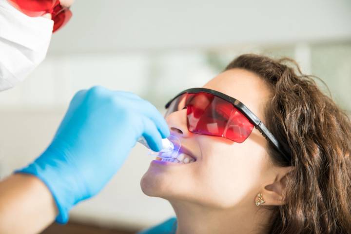 limpieza-dental-importancia-beneficios-recomendaciones imagen de artículo