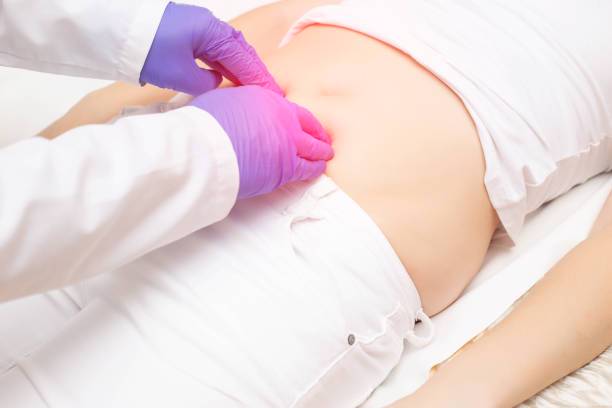 hernia-inguinal-detectar-operacion imagen de artículo