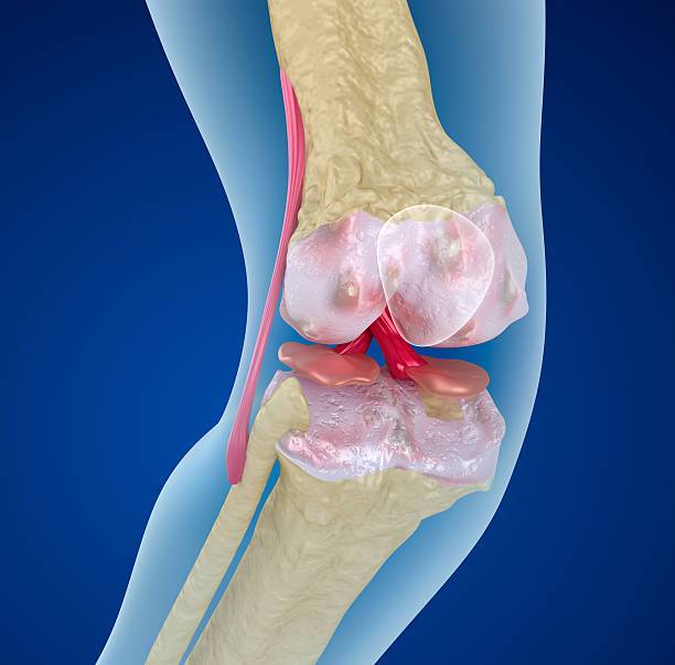 celulas-madre-rodilla-alternativa-innovadora-en--ortopedia imagen de artículo